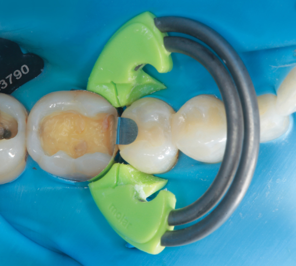 Courtesy of Dr. Parag Kachalia