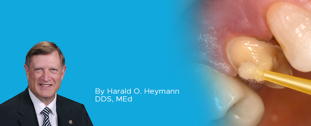 Post-Feature-Image-Dr-Heymann-G5-article-1200×487 Clinical Article on Desensitization Protocol