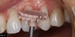 Class IV clinical A,S,A,P, Final High Shine