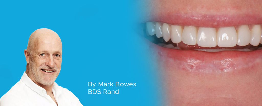 Dr-Bowes-Clinical-Article-Feature-Image Dr-Bowes-Clinical-Article-Feature-Image