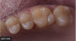 Dr. McClintock Class II Protocol article - BEFORE