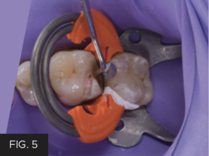 Dr. McClintock Class II Protocol article - FIG 5