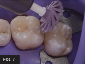Dr. McClintock Class II Protocol article - FIG 7