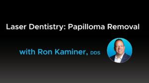 Laser Dentistry - Papilloma Removal - Video