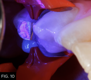 Optimizing-Aesthetics-Predictability-clinical FIG 10