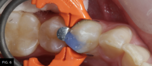 Optimizing-Aesthetics-Predictability-clinical FIG 6