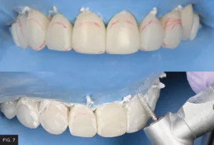 line traced indicating height of contour