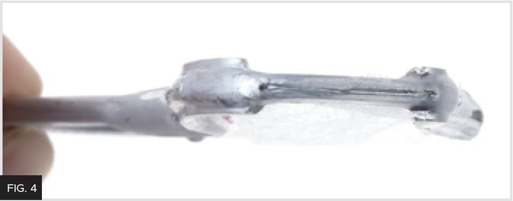 Quad-Tray Ultimate Posterior thinner wall