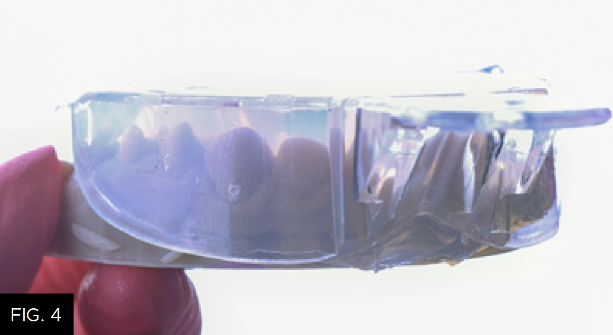 Affinity Crystal Clear in clear impression tray wax-up model