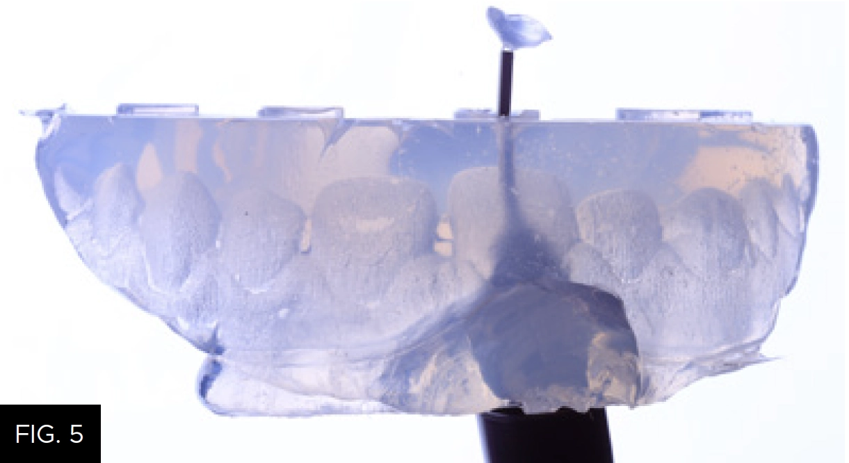 mixing tip puncture impression over tooth