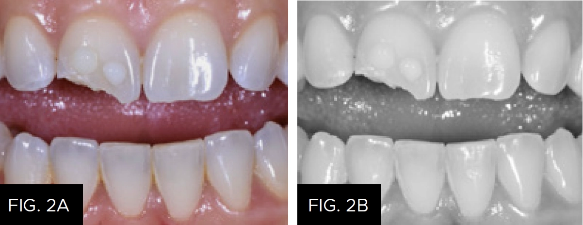 composite shade and value selection