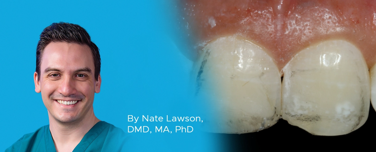 Nate Lawson, Ask Expert, composite polishers