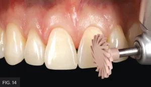 high luster restoration, 2-step diamond polishingsystem