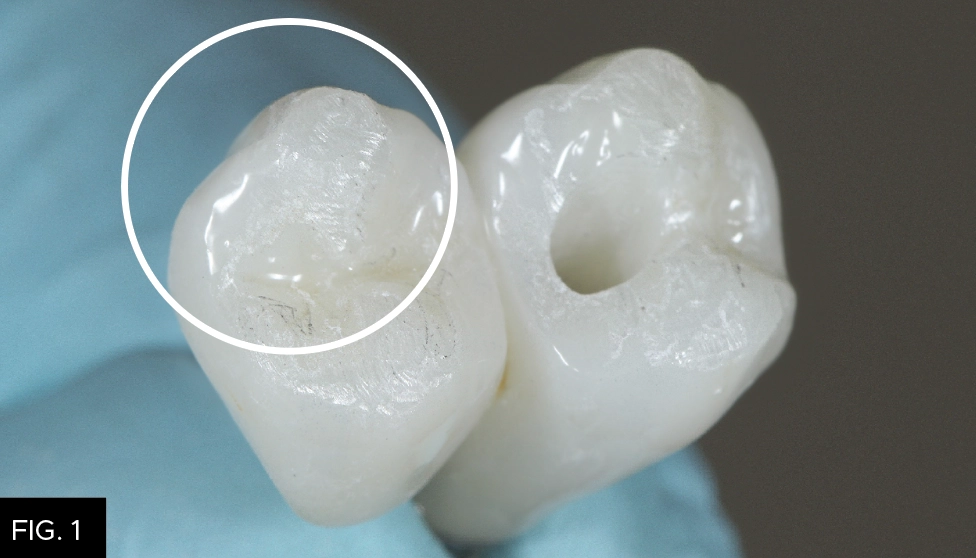 extra oral adjustment, polisher