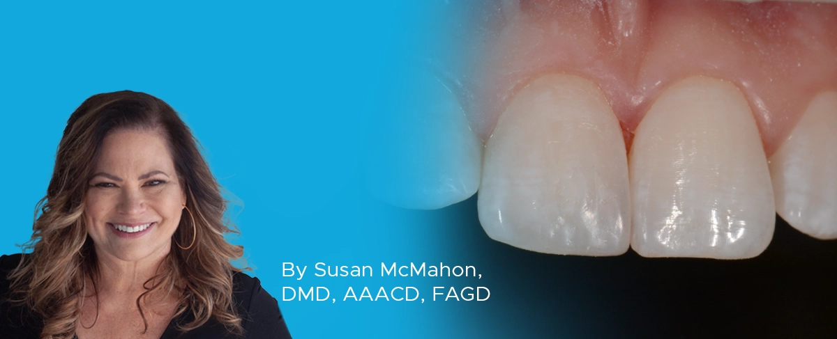 Dr-McMahon-Starburst-Bevel-Article-Image Dr. McMahon Starburst Bevel article banner