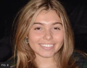 post-operative full-face portrait view