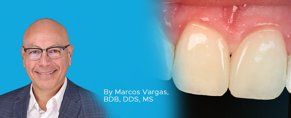 Clinical article banner diastema Dr. Marcos Vargas