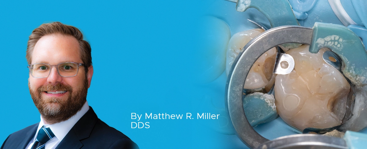 article banner ask the expert sectional matrix system Matthew Miller