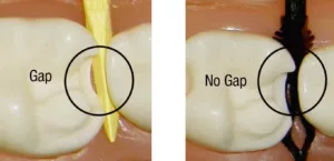 article image DualForce Deep Seal Active-Wedge