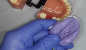 clinical impression Template matrix material