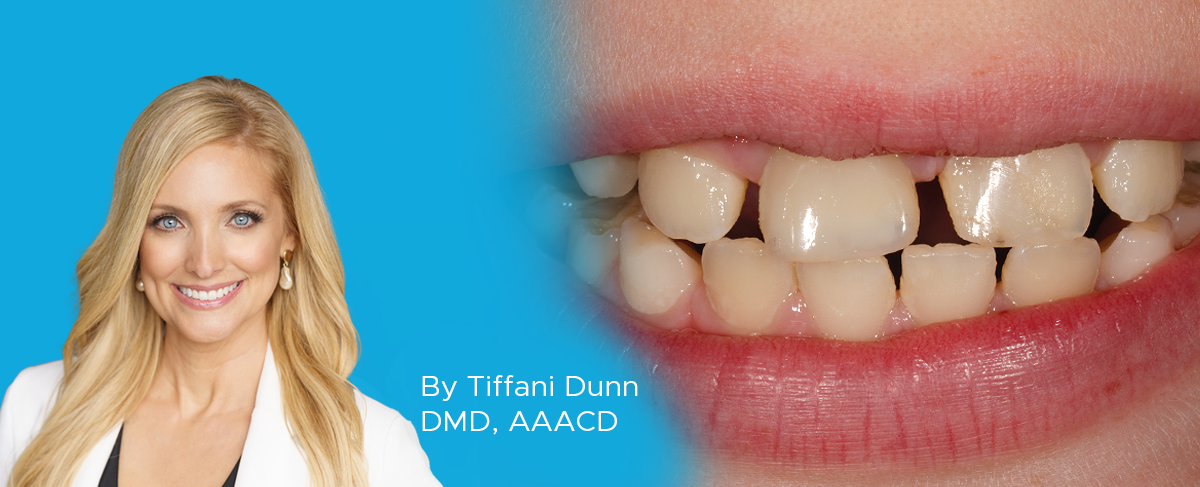 Dr. Tiffani Dunn, article, banner