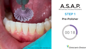 More Shine in Less Time with A.S.A.P. All Surface Access Polishers
