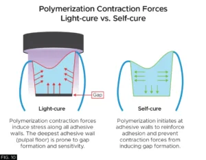 diagram, Light-cure vs. Self-cure