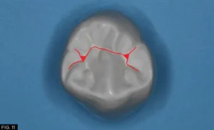 anatomical guidelines, occlusal