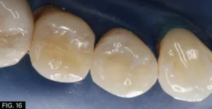 restorative, clinical