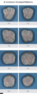 8 common occlusal patterns